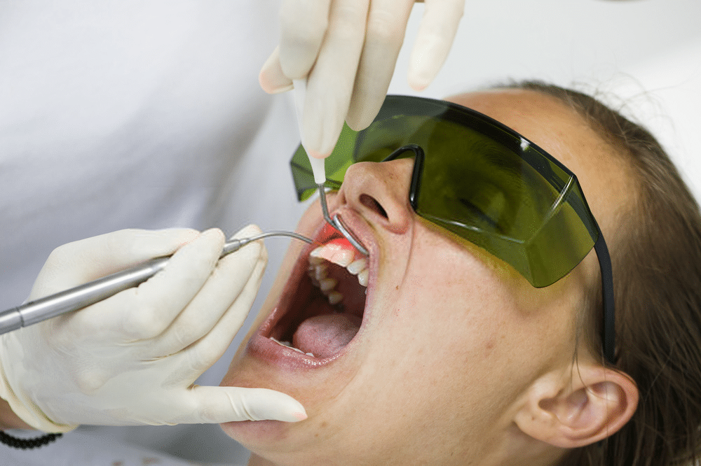laser dental treatment in hyderabad