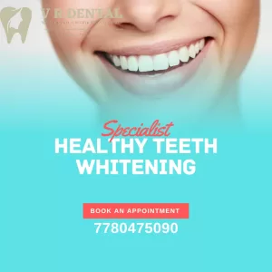 Teeth whitening cost