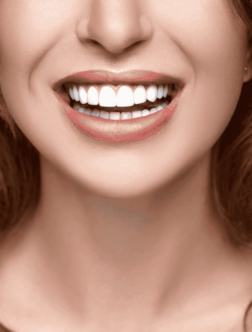 Cosmetic Dentistry Kukatpally